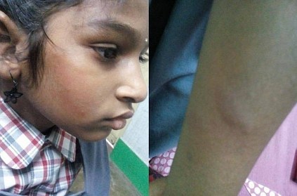 Sad: 9-yr-old beaten over this silly reason, teacher suspended