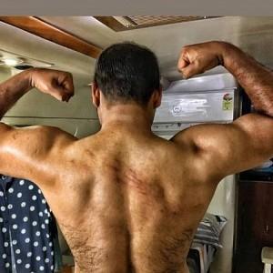 Kunchacko Boban shares pics of his bruises from the shooting spot